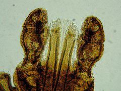 Dermacentor andersoni mouthparts