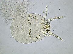 Eutrombicula alfreddugesi (larva)