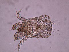 Dermatophagoides (dust mite)
