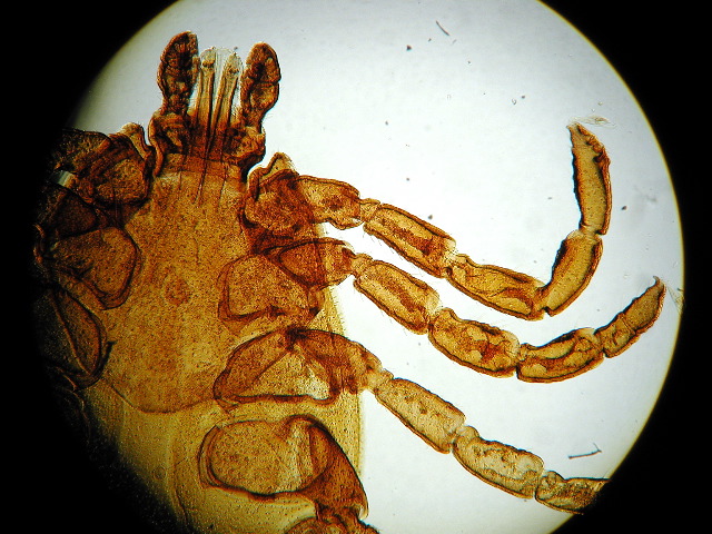 Dermacentor andersoni (adult)