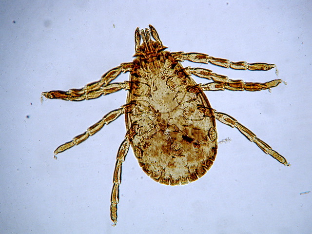 Dermacentor andersoni (nymph)