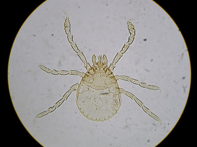 Dermacentor andersoni (larva)