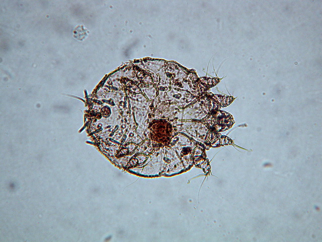 Sarcoptes scabiei