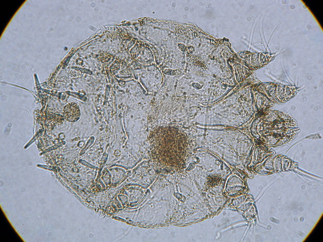 Sarcoptes scabiei