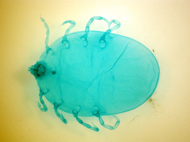 Ixodes ricinus