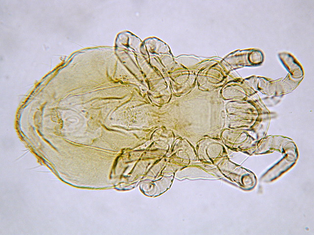 Ornithonyssus (dorsal)
