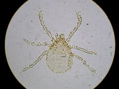Dermacentor andersoni (larva)