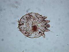 Sarcoptes scabiei