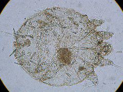 Sarcoptes scabiei