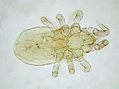 Ornithonyssus (ventral)