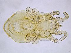 Ornithonyssus (dorsal)