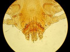 Boophilus annulatus