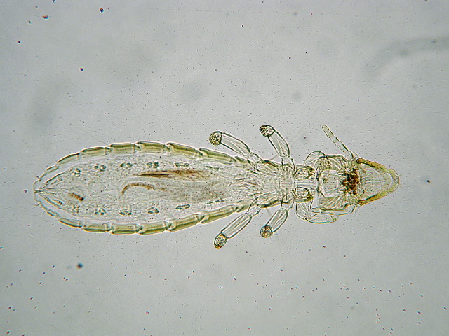 Columbicola columbae